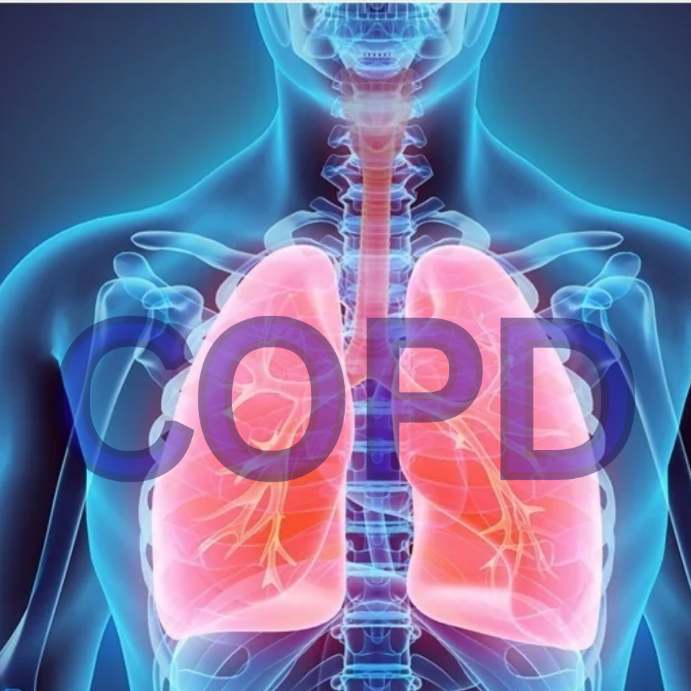 copd research cork athtrasna